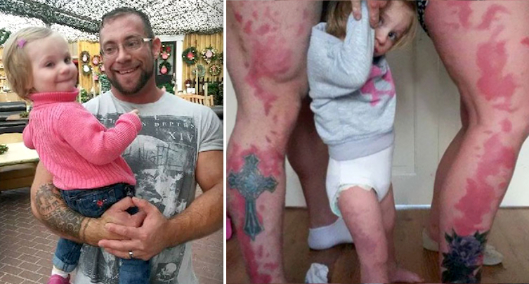 Ces parents se font tatouer le motif de la tache de naissance de leur fille 5